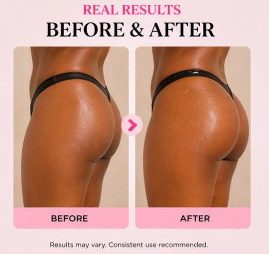 Before and after comparison of a person using Get Thick Products 