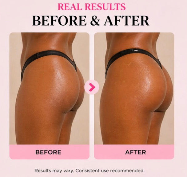Before and after comparison of a person using Get Thick Products 