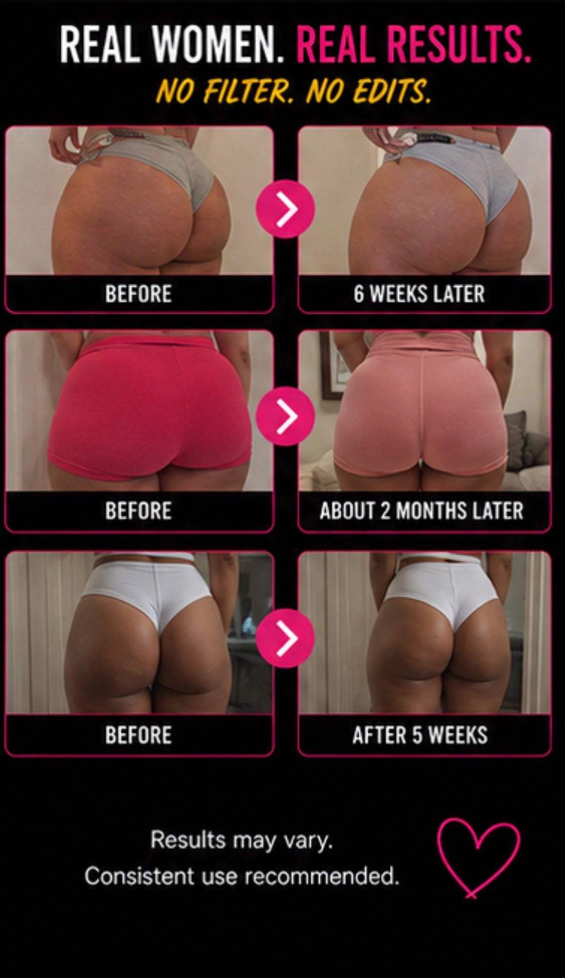 Before and after transformation of a woman's butt with text indicating time frames and results.