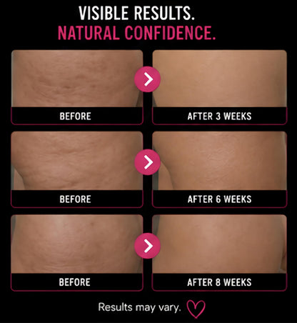 Before and after results of a skin treatment with visible confidence improvement over time.from Get Thick Products 